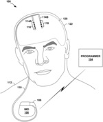 TEMPLATE-BASED DETERMINATION OF ELECTROPHYSIOLOGICAL SIGNAL SOURCES