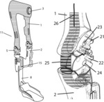 Unloading knee-ankle-foot orthotic apparatus with conforming and distracting hinge