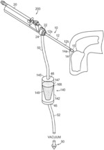 Tissue trap for chondral autograft transfer system
