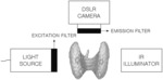 Real-time parathyroid imaging system