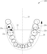 Operating intraoral scanner capable of constructing accurate dental model and method thereof