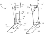 FOOT ANKLE ORTHOSES