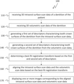AUTOMATIC REGISTRATION OF INTRAORAL SURFACE AND VOLUMETRIC SCAN DATA FOR ORTHODONTIC TREATMENT PLANNING