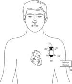 Method and system to detect r-waves in cardiac arrhythmic patterns