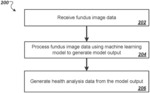 Processing fundus images using machine learning models