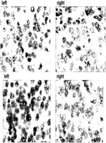 Set of Oligonucleotide Probes as Well as Methods and Uses Thereto