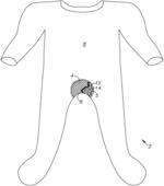 GARMENT WITH OBSERVATION PANEL FOR UNDERLYING DIAPER