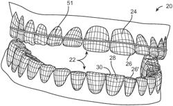 Three-dimensional printed dental appliances using lattices