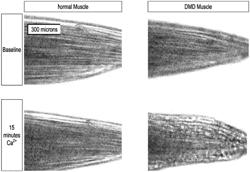 PYRIDAZINONE COMPOUNDS FOR THE TREATMENT OF NEUROMUSCULAR DISEASES