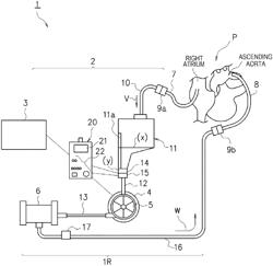 Extracorporeal circulation management device with blood level detection in a reservoir without a sensor