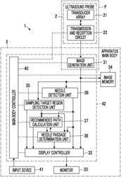 ULTRASOUND DIAGNOSTIC APPARATUS AND CONTROL METHOD OF ULTRASOUND DIAGNOSTIC APPARATUS