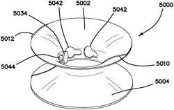 SYSTEMS AND METHODS FOR TISSUE REMOVAL