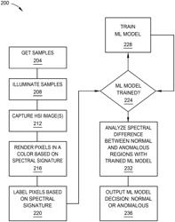 ARTIFICIAL INTELLIGENCE-BASED HYPERSPECTRALLY RESOLVED DETECTION OF ANOMALOUS CELLS