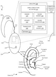 PINNAL DEVICE