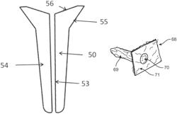 Demineralized bone fiber implant compositions and methods for rotator cuff and ACL repair