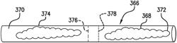 Apparatus, arrangement and method for providing skin care ingredients