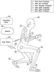 IMPLANTABLE REPORTING PROCESSOR FOR AN ALERT IMPLANT