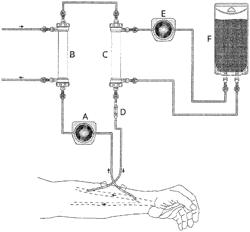 DIALYSIS SYSTEM FOR TREATING SEPSIS