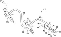 Endoscopic suture loop anchors and methods