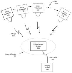 X-RAY SENSOR SYSTEM FOR INTRAORAL TOMOGRAPHY