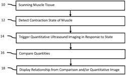 Muscle contraction state triggering of quantitative medical diagnostic ultrasound