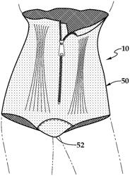 Therapeutic garment for treatment of over-shunting headaches and method for use of same