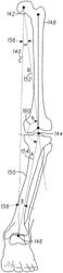 Orthopedic leg alignment system and method