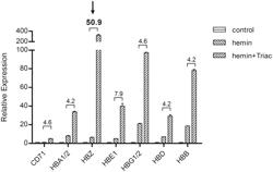 APPLICATION OF THYROID HORMONES AND THYROID HORMONE ANALOGUES TO PREPARATION OF DRUGS FOR TREATING SICKLE-CELL DISEASE