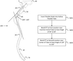 Endotracheal tube with fulcrum