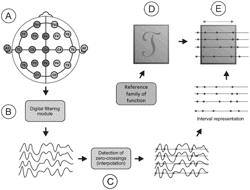 Method for identification of pathological brain activity from scalp electroencephalogram