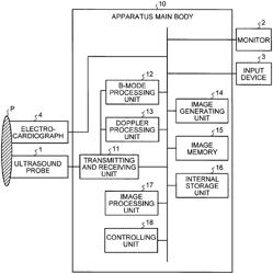 ULTRASOUND DIAGNOSIS APPARATUS, IMAGE PROCESSING APPARATUS, AND IMAGE PROCESSING METHOD