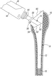 ORTHOPAEDIC SURGICAL INSTRUMENTS FOR DIRECT ANTERIOR APPROACH HIP ARTHROPLASTY AND METHODS OF USE