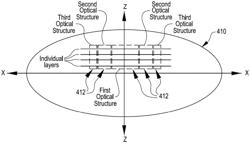 Myopia progression treatment