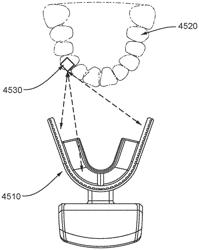 ORTHODONTIC APPLIANCE COMPLIANCE MONITORING SYSTEMS, DEVICES, AND METHODS