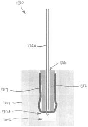 SYSTEMS, DEVICES, AND METHODS FOR SECURING TISSUE USING HARD ANCHORS