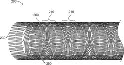 Stents having a hybrid pattern and methods of manufacture