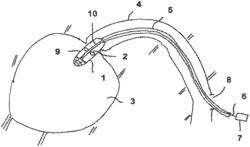 CONVEYING BLADES FOR A COMPRESSIBLE ROTOR