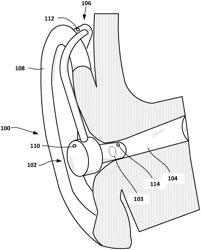 APPARATUS AND METHOD FOR REVERBERATION MITIGATION IN A HEARING DEVICE