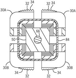 Expandable intervertebral implant