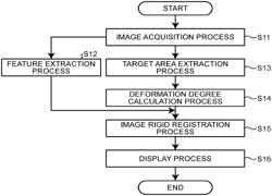 MEDICAL IMAGE PROCESSING APPARATUS, MEDICAL IMAGE PROCESSING METHOD, AND RECORDING MEDIUM