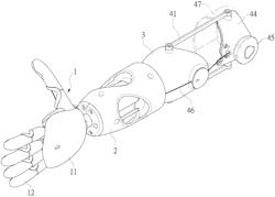 BELOW-ELBOW PROSTHETIC ARM ASSEMBLY