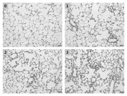 COMPOSITIONS FOR PREVENTING OR TREATING CHRONIC OBSTRUCTIVE PULMONARY DISEASES (COPD)