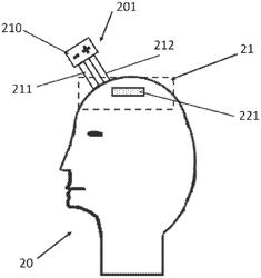 METHOD FOR DETERMINING A SCALP TYPE OF A USER