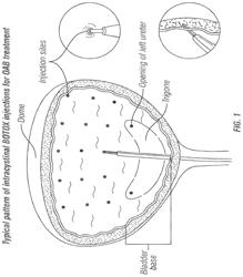 FORMULATIONS OF BIOLOGICS FOR INTRAVESICAL INSTILLATION