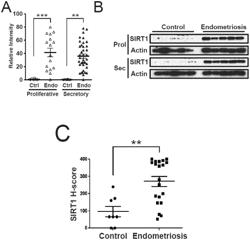 METHODS AND COMPOSITIONS FOR SIRT1 EXPRESSION AS A MARKER FOR ENDOMETRIOSIS AND SUBFERTILITY