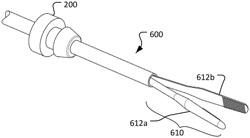 SYSTEMS AND METHODS FOR TREATING HEARING LOSS