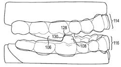 DENTAL APPLIANCE WITH REPOSITIONING JAW ELEMENTS