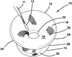 Systems and methods for tissue removal