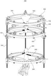 Bone transport external fixation frame