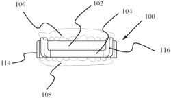 MANDIBULAR ADVANCEMENT DEVICE